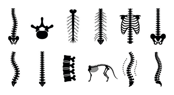 Human spine vertebrae skeleton bone anatomy icons set, showing various views and conditions of the spinal column in a flat vector illustration style