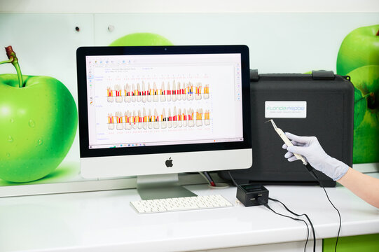 Florida Probe periodontal system with digital tooth chart on monitor