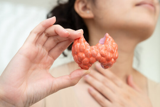 Hyperthyroidism, Overactive Thyroid, Thyroid Lymphoma, Asian woman with thyroid gland human anatomy model.