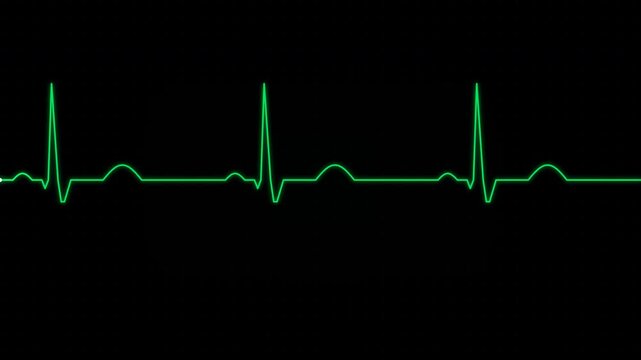 Medical motion of an electrocardiogram heartbeat pattern showing rhythmic heart activity for healthcare and diagnostic visualization.