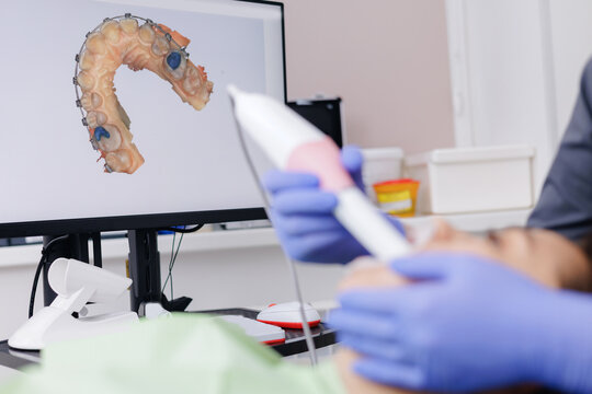 Dentist performing digital dental 3D scan on young patient with braces in clinic