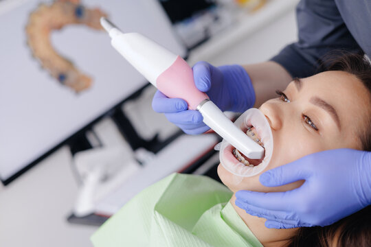Asian female undergoing dental scan with intraoral camera in clinic, top view