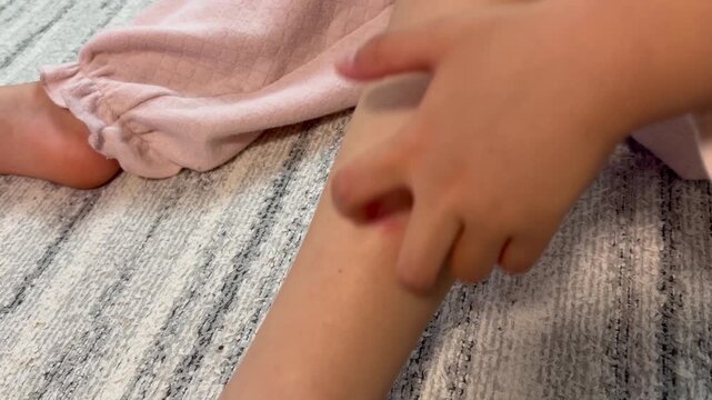 虫刺されを掻く子供