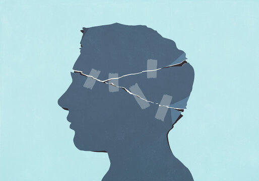 Torn profile of man's head taped together with adhesive tape on blue background