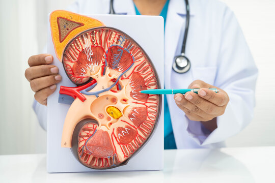Chronic kidney disease, doctor with model for treatment urinary system, urology, Estimated glomerular filtration rate eGFR.