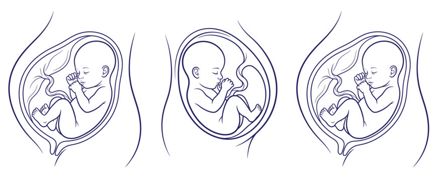 Three detailed illustrations of human fetus inside womb, showing different stages of development and position in line art style for medical education.