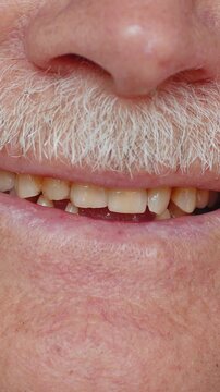 Close-up macro shot of toothless male smile mouth of senior mature man. Dental problem, bad teeth loss. Pensioner grandfather guy showing rotten teeth, caries, decayed, weak enamel, teeth falling out.