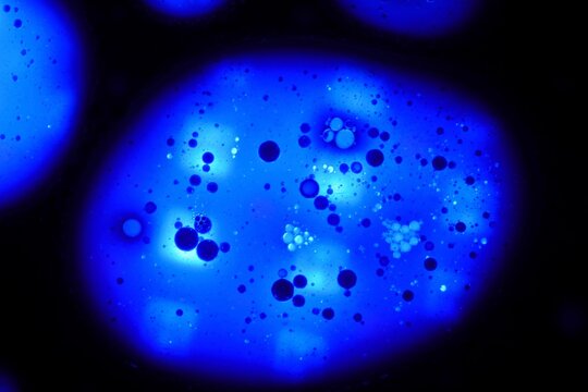 Photomicrograph seen under a microscope