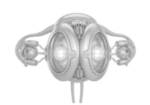 Artificial Cybernetic Ovaries 3D Render with Platinum Bio Reactor and Rose Glowing Follicle Chambers