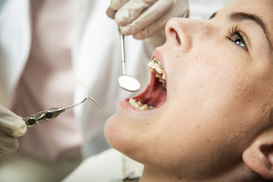 Young Woman Receiving a Routine Dental Examination