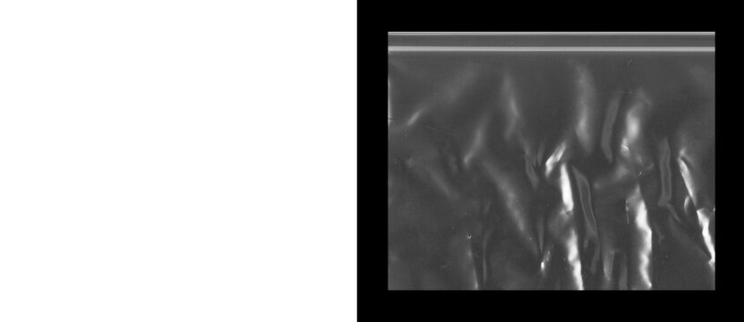 Abstract ultrasound scan texture, grainy medical imaging background, monochrome sonogram ripples and distorted noise patterns