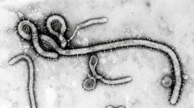 Transmission electron micrograph of ebola virus particles