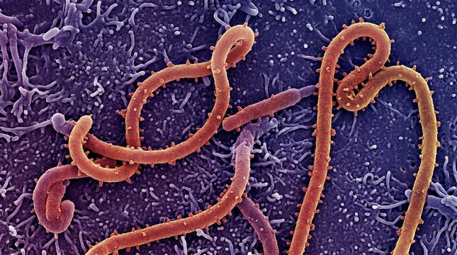 Scanning electron micrograph of ebola virus particles
