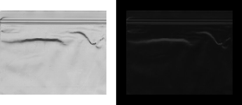 Abstract ultrasound scan texture, medical sonography imaging background, grainy monochrome medical diagnostic display, clinical sonogram visual