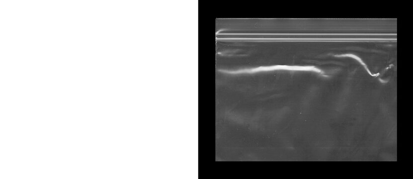 Abstract ultrasound scan texture, medical sonography imaging background, monochrome diagnostic sonogram display with grainy noise and wave patterns