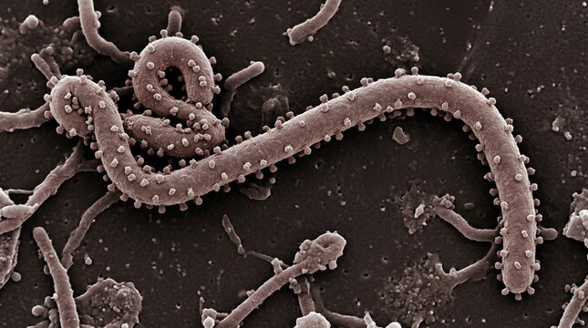 Scanning electron micrograph of ebola virus particles