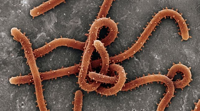 Scanning electron micrograph of ebola virus particles