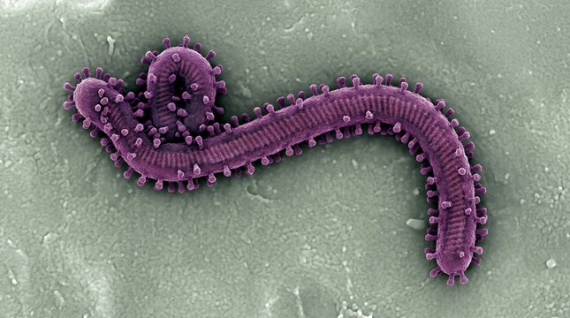 Scanning electron micrograph of an ebola virus particle