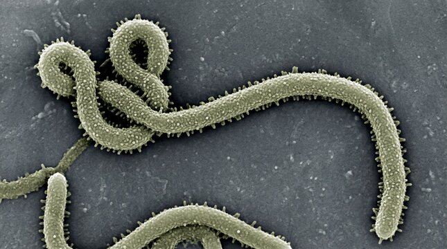 Scanning electron micrograph of ebola virus particles
