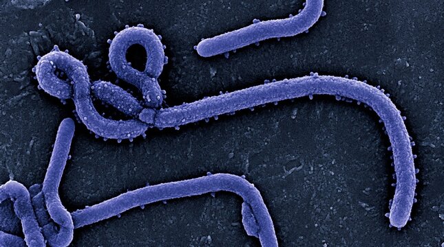 Scanning electron micrograph of ebola virus particles