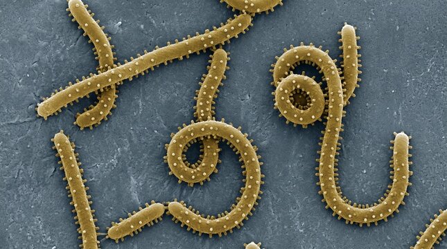 Scanning electron micrograph of leptospira bacteria