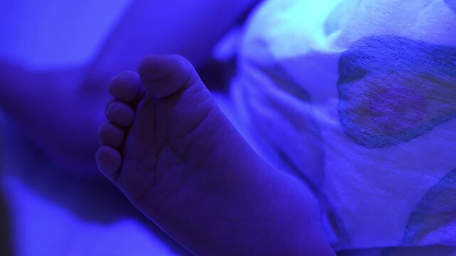 Close up on the tiny feet of a newborn baby receiving blue light phototherapy treatment for hyperbilirubinemia, a common therapy in neonatal wards to reduce jaundice levels