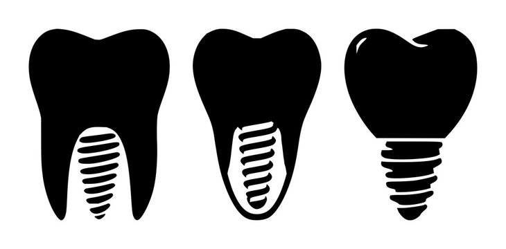 Dental implant tooth icon set with solid black icon on white background featuring dental, implant, tooth with iconography and white backdrop