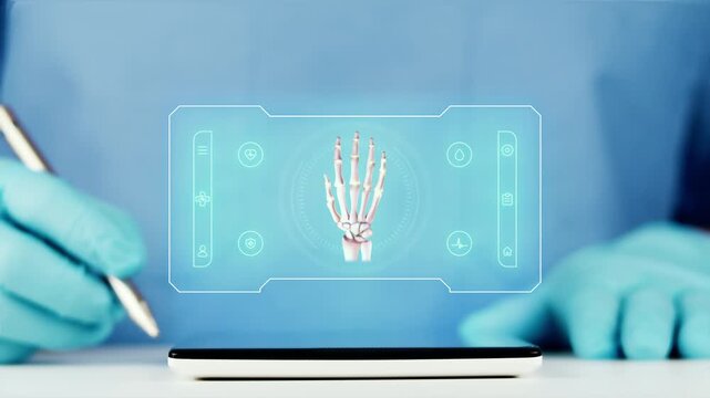 The doctor presents a digital interface for hand osteoarthritis. Concept of rheumatology and orthopedics, telemedicine with AI for monitoring and analyzing joint degeneration