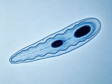 A micrograph of blood stained with Giemsa stain shows Trypanosoma brevicornu, characterized by its slender body, wavy membrane, pale blue cytoplasm, and dark nucleus.