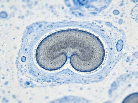 Micrograph of Wright-Gymsa staining blood smear, showing human monocytes with characteristic kidney-shaped nuclei, gray-blue cytoplasm, true hematological staining, natural blood smear.