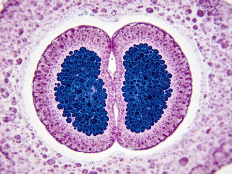A micrograph of a Wright-Gymsa stained blood smear showing human basophils with characteristic bilobed nuclei containing numerous dark blue granules.