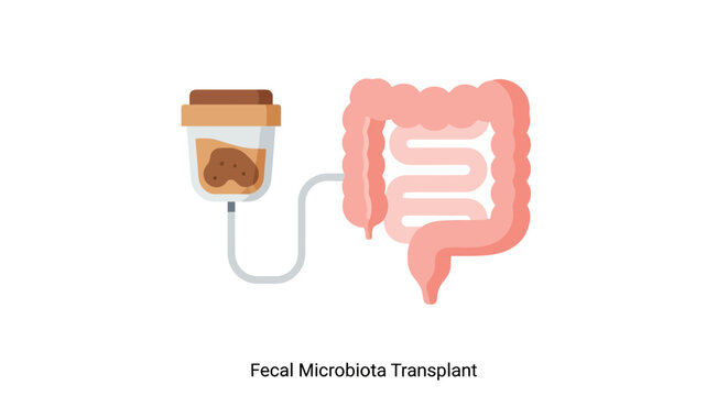 Fecal Microbiota Transplant Concept: Intestine Connected to Sample Container