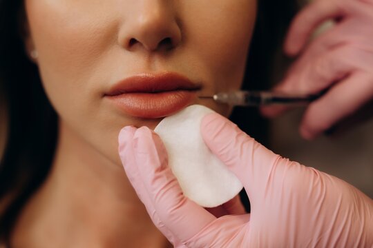 Woman getting lip filler injection for beauty enhancement