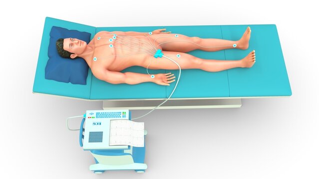 An electrocardiogram (ECG or EKG) is a quick, safe, and noninvasive test that records the electrical signals of your heart to check for heart rhythm issues, structural damage, or signs of a heart atta