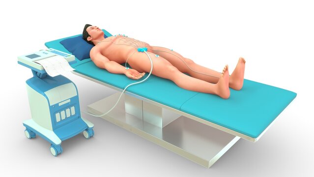 An electrocardiogram (ECG or EKG) is a quick, safe, and noninvasive test that records the electrical signals of your heart to check for heart rhythm issues, structural damage, or signs of a heart atta