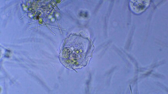 Micro organism - amoeba, time lapse
