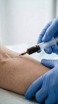 Extreme close-up of a nurse's hand taking a patient's blood sample from a vein with a syringe in a clinic, minimalist medical procedure
