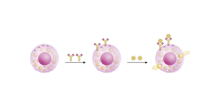 Resting and activated mast cell. Anaphylactic, allergic reaction, Autoimmune disorders, allergy and anaphylaxis. IgE antibodies are involved in Anaphylactic reaction. Vector illustration.