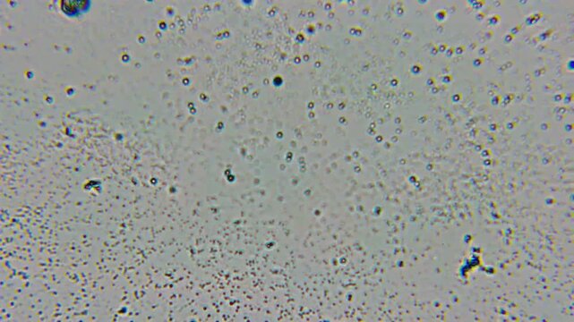 Microscopic Examination of a Milk Sample Reveals Scattered Fat Globules and Protein Micelles Dispersed Throughout Liquid Emulsion. Tiny Dark Specks and Bubble Clusters Form Patterns on Grayish Field.