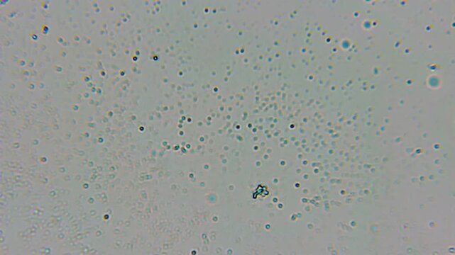 High-magnification Microscope Captures Dense Milk Fat Droplets, Protein, Casein Micelles With Bacterial Clusters Across a Slide Sample. Blue gray Plasma Swirls With Granular Dots and Spherical Points