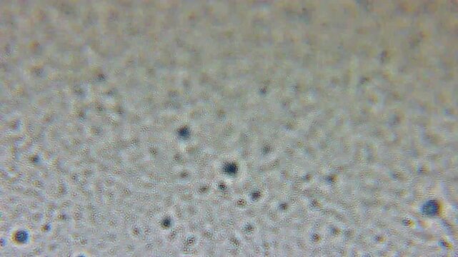 Optical Microscope Shifts Focus Across a Milk Sample, Revealing Spherical Lipid Globules, Protein, Casein, Scattered Particulates Floating in Fluid. Blue-gray Blend With Circular Dots and Soft Blurs.