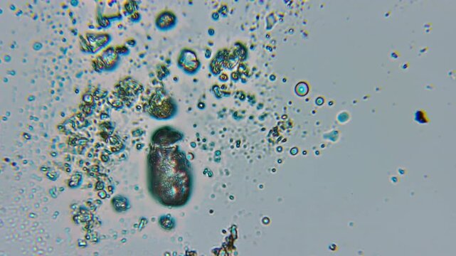 Microscope Examines Melted Snow Sample, Revealing Crystalline Ice Fragments, Airborne Pollutants, and Trapped Debris Floating in Aqueous Medium. BlueField Scatters Dark Clusters With Prismatic Dots.