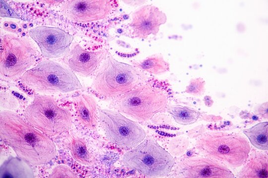 Microscopic analysis of oral mucosa highlighting squamous cells and bacteria using HE stain with copyspace