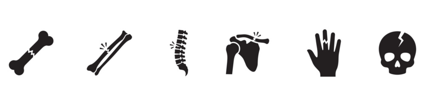 Broken bone icon set. Human skeleton fracture symbols, spine injury, joint pain, cracked skull and hand trauma silhouette. Medical diagnosis. Vector illustration. Vector Graphic. EPS 10