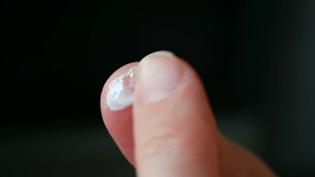 Macro shot focusing on fingertip applying white moisturizing lotion to treat dry, cracked, chapped skin, providing relief, hydration for dermatological health, skin care. Applying moisturizing cream