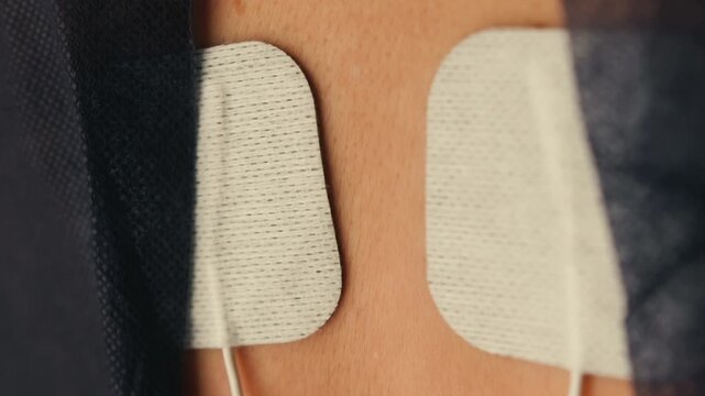 Patient undergoing physiotherapy with electrical stimulation on the back in a medical clinic. Electrodes attached to the body for muscle recovery, pain relief and rehabilitation treatment. High