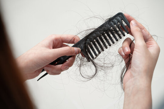 Asian woman have problem with long hair loss attach to comb brush.