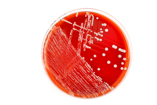 Red petri dish with bacteria on white background