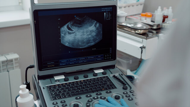 Ultrasound machine in the clinic