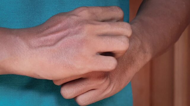 Asian man's hand Scratching itchy wrist close up